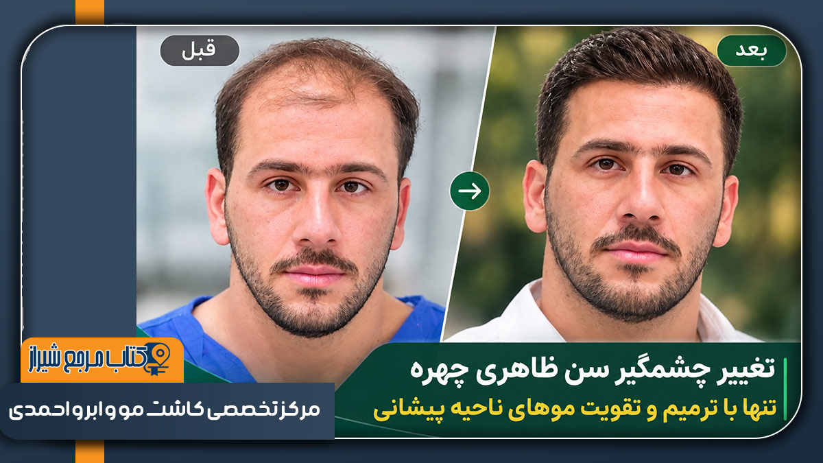 مرکز تخصصی کاشت مو و ابرو احمدی