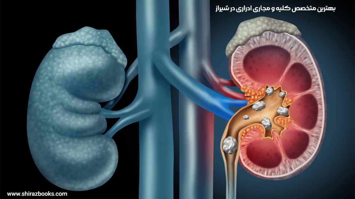 10 بهترین متخصص کلیه و مجاری ادراری در شیراز
