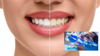 10 بهترین متخصص بلیچینگ دندان در شیراز