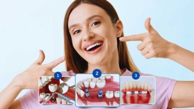 10بهترین متخصص ایمپلنت دندان در شیراز