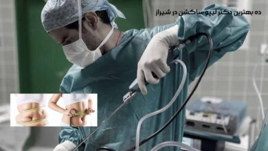 10 بهترین دکتر لیپوساکشن در شیراز