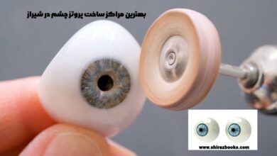 بهترین مراکز ساخت پروتز چشم در شیراز