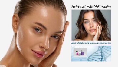 10 بهترین دکتر اگزوزوم تراپی در شیراز