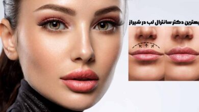 10 بهترین دکتر سانترال لب در شیراز